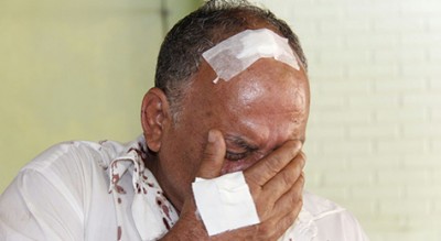 Ladrões arrancam dente de comerciante torturado durante assalto a bar na  Capital