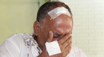 Ladrões arrancam dente de comerciante torturado durante assalto a bar na Capital
