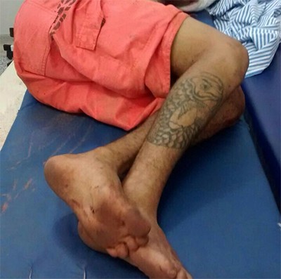Foragido da Unei de Dourados é baleado pela PM em município vizinho