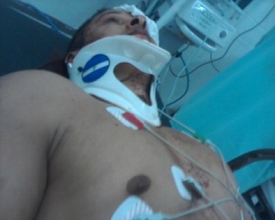 O ex-policial no dia da confusão, ao ser socorrido. (Reprodução)