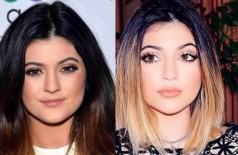 Kylie Jenner antes e depois (Reprodução)
