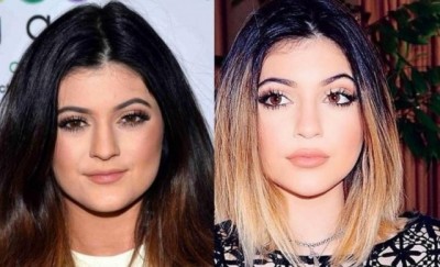 Kylie Jenner antes e depois (Reprodução)