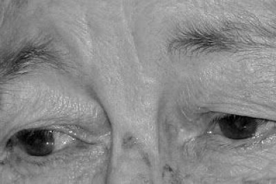 Idosa de 86 anos é agredida com várias coronhadas na cabeça durante roubo