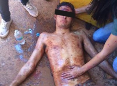 Jovem que teve coma alcoólico durante trote diz que teve de beber 'na marra'