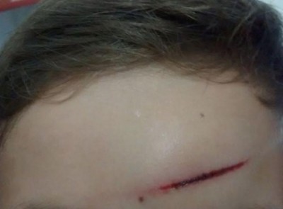 Ventilador cai em sala durante aula e duas crianças ficam feridas em MS