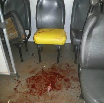 Imagem publicada em redes sociais mostram sangue de estudantes que ficaram feridos em ônibus que passou em alt... (Reprodução/Facebook)