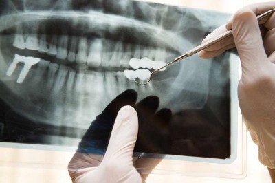 Depois de analisar muito o problema, o dentista conseguiu enxergar um possível e preciso diagnóstico: a dor de... (hxdbzxy / Shutterstock)