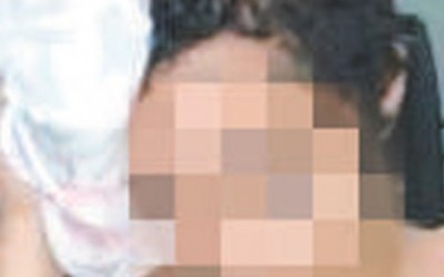 Criança adepta do Candomblé é atingida por pedrada na cabeça (Reprodução)