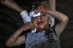 Criança síria é socorrida em um hospital de campo após bombardeio de forças do governo a um mercado popular em... (Ammar Suleiman/AFP)