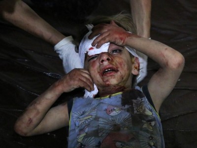 Criança síria é socorrida em um hospital de campo após bombardeio de forças do governo a um mercado popular em... (Ammar Suleiman/AFP)