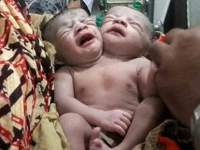 A bebê recebe atendimento em um hospital de Brahmanbaria (STR)