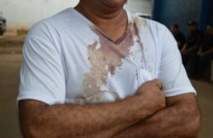 Comerciante com marcas de sangue na camiseta; ele conta que foi agredido por assaltantes ((Foto Bianca Bianchi))