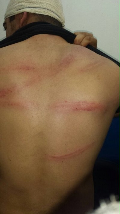 Policial militar exibiu marcas da agressão que diz ter sofrido durante o período em que foi mantido refém por... (Sidnei Bronka (94FM))