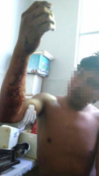 Índio baleado durante o ataque de segunda-feira teve imagem divulgada pelo CIMI (Divulgação/CIMI)