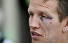 Judoca belga Dirk Van Tichelt com o olho roxo após ser agredido em roubo no Rio (Twitter/Reprodução)